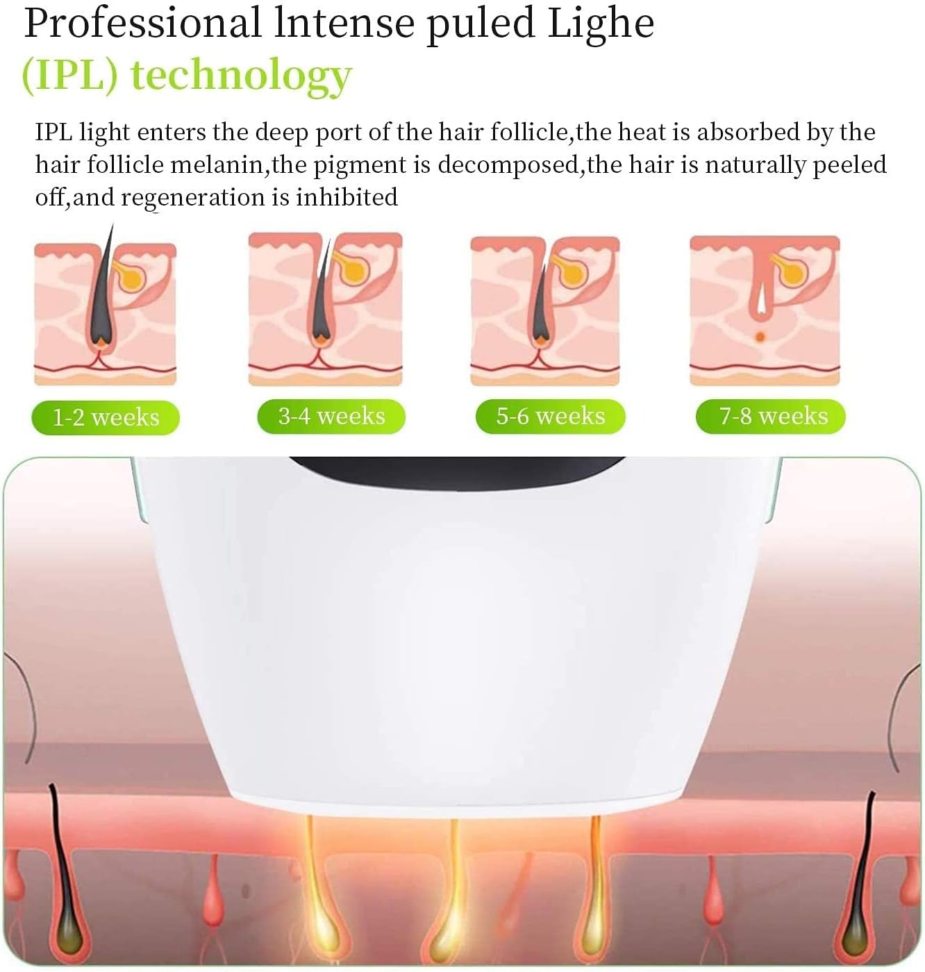 Laser Hair Removal  System